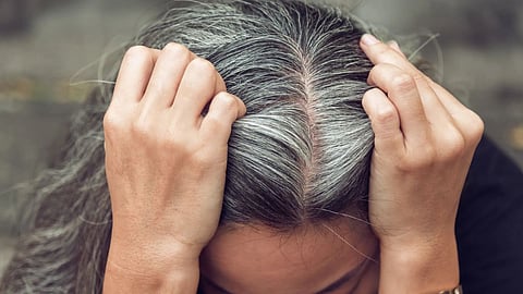 White Hair Care
