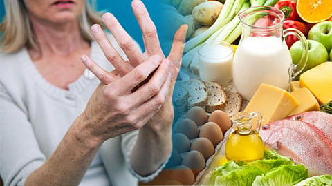 Arthritis Diet 