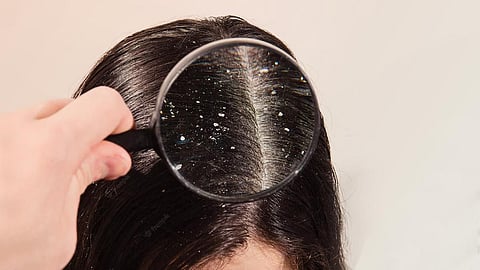 Hair Care Tips 