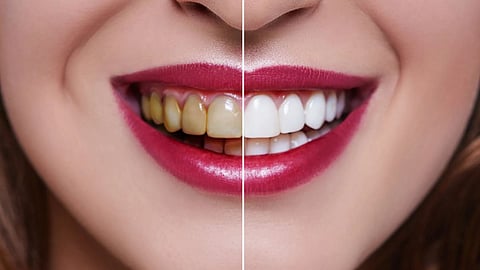 Teeth 