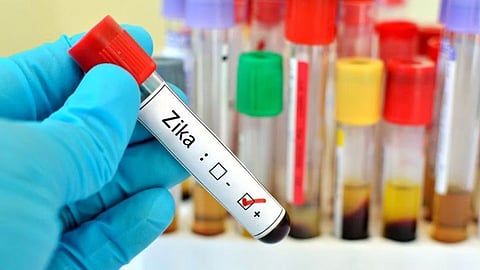 Pune Zika Virus Update
