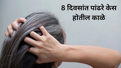 Remedy For White Hair