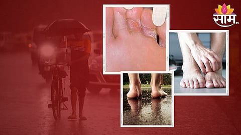 Foot Care Tips