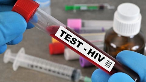 HIV Positive