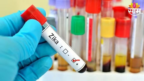 Pune Zika Virus Cases: चिंताजनक! 'झिका' विषाणूचा प्रसार वेगात; रुग्णांची संख्या २८ वर, आरोग्य विभाग Alert मोडवर
