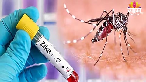 Zika Virus Information: झिकाकडे दुर्लक्ष कराल,जीवाला मुकाल? महिलांना सर्वात जास्त धोका? जाणून घ्या लक्षणे