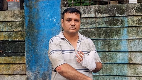 Mumbia News: भयंकर! सोसायटी मिटिंगमध्ये तुफान राडा, अध्यक्षाने सभासदाचा अंगठा चावून तोडला