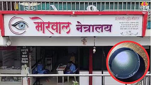 महिलेच्या डोळ्यात जिवंत अळ्या