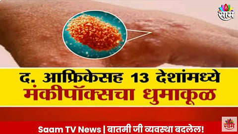 Monkeypox Virus