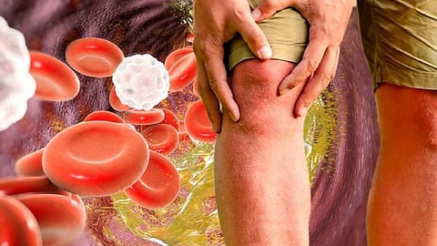 High cholesterol symptoms