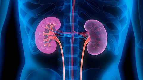 One Kidney