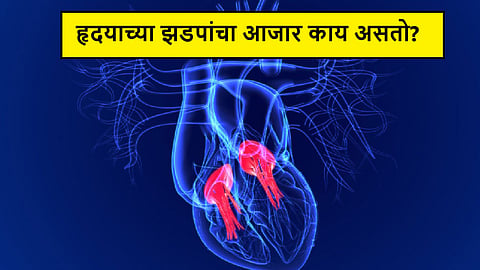 Heart Valve Disease