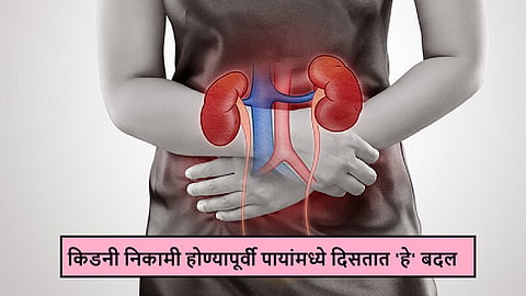 Signs Of Kidney Damage