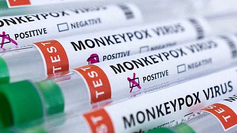 Mpox test kit