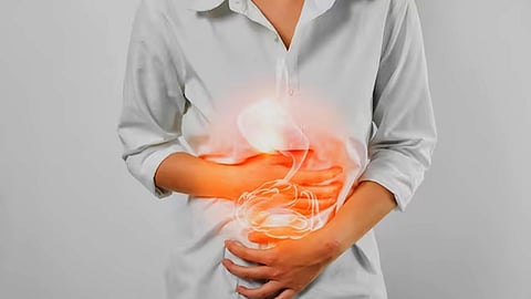 Stomach Cancer