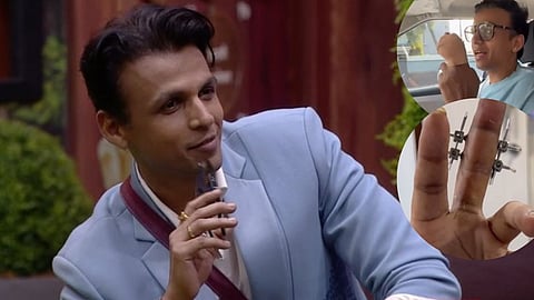 Abhijeet Sawant Finger Injury Update 