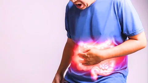 Remedies for Acidity
