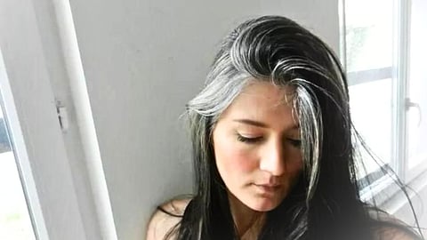 white hair solution