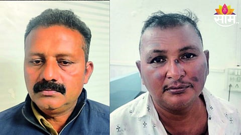 Bribe Case