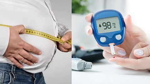 Diabetes due to obesity