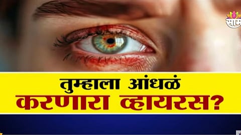 Bleeding Eye Virus
