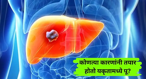 Causes pus in the liver