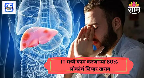 Fatty Liver Risk Factor