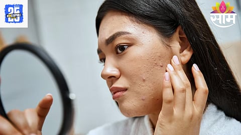 Skin Care Tips