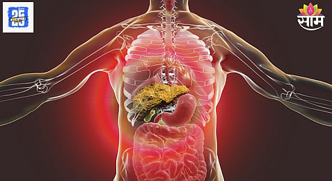 Liver cirrhosis