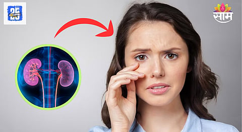 Kidney Damage Symptoms on face