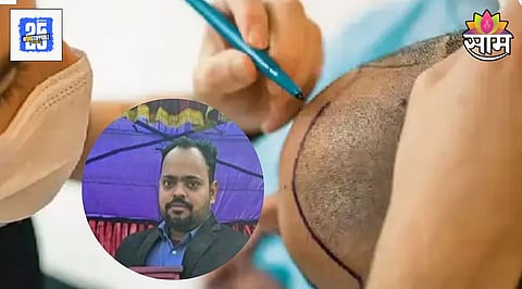 Hair Transplant Vineet Dubey Death