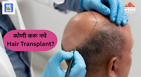 Hair Transplant
