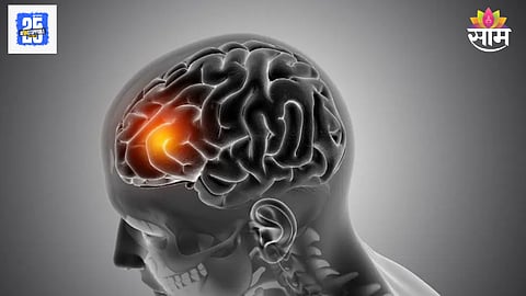 Brain tumor symptoms
