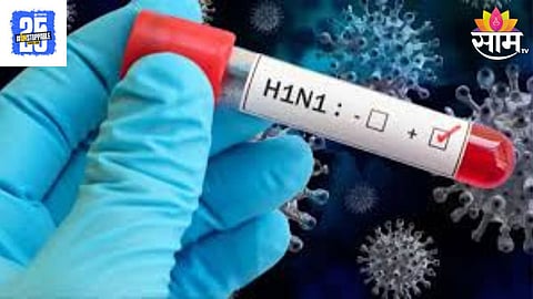 Swine Flu