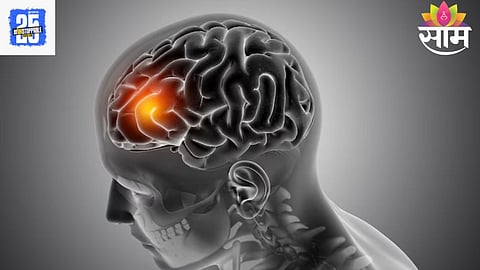 brain Tumors