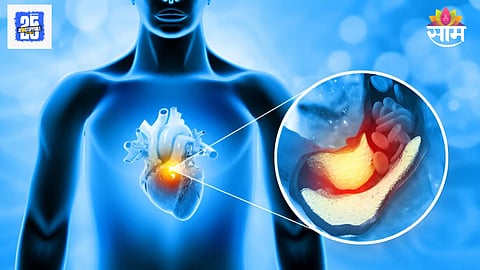 What is Thick Heart Syndrome