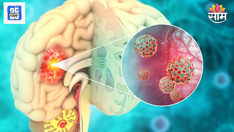 Changes in body before brain tumor