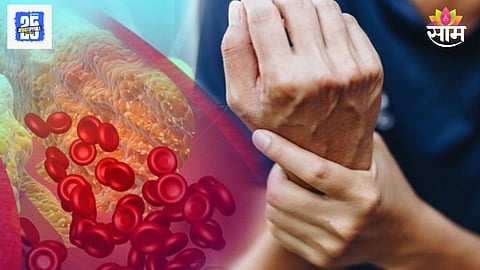 High cholesterol pain symptoms