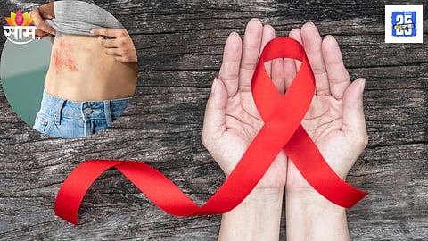 HIV Symptoms