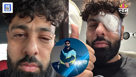 Badshah Injury 