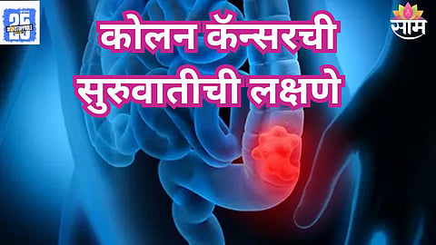 abdominal pain symptoms