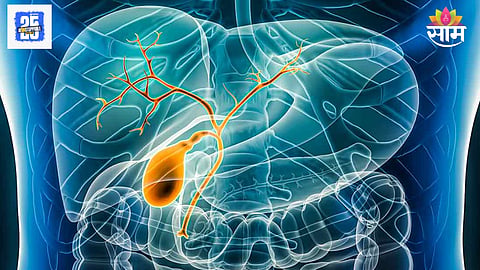 Bile duct cancer: पित्तवाहिन्यांचा कॅन्सर होण्यापूर्वी शरीर देतं 'हे' संकेत; वेळीच निदान वाचवेल तुमचा जीव