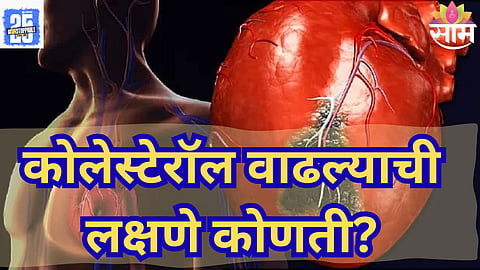 cholesterol warning signs