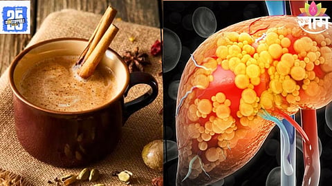  tea side effects