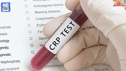 Blood Test