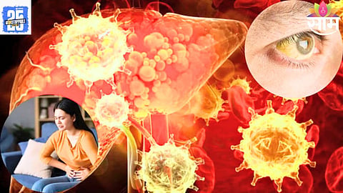 Liver Care Tips