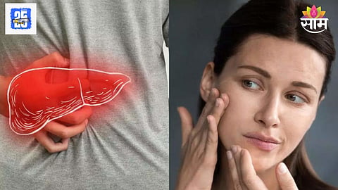 Fatty liver warning