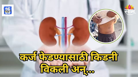 Kidney Racket : ५० हजार घेतले, ७४ लाख झाले; कर्ज फेडण्यासाठी शेतकऱ्यांनी विकल्या किडन्या, विदर्भातील प्रकरणाने राज्यात खळबळ