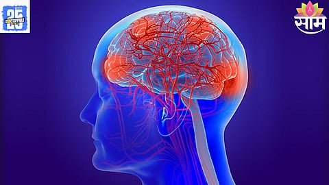 Brain Nerve Damage