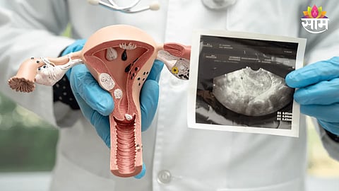 Cervical cancer